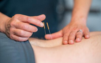 Spinal Surgery: The Role of Physiotherapy Before and After